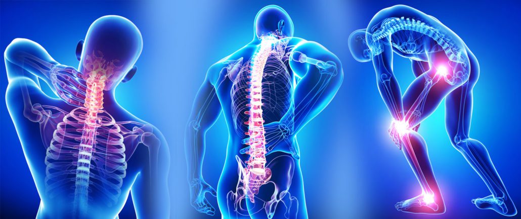 Backbone Pain - Bone Pain - Best Los Angeles Chiropractor