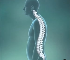 Get a precise spinal adjustment in Los Angeles from Dr. Karr — same-day digital X-rays, no guessing. Most PPO accepted. Call 310-914-9400.
